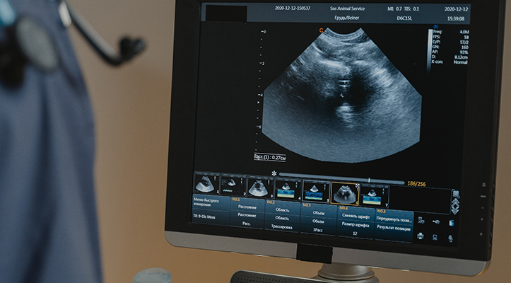 pexels-tima-miroshnichenko-6234614 Ultrasound